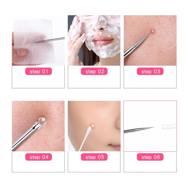 1pcs Silver Blackhead Comedone Acne Pimple Blemish Extractor Remover Stainless Needles Remove Tools Face Skin Care 5 Beauty-Health 1pcs Silver Blackhead Comedone Acne Pimple
