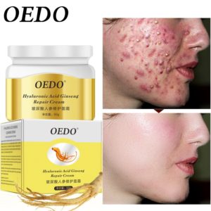 Hyaluronic Acid Ginseng acne cream Anti acne print Face cream remover acne treatment Facial Eliminates Oil 1 Beauty-Health Mega Shop
