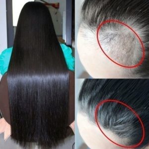 30 20 10 ML Effective Hair Growth Serum Fast Thick for Hair Prevent Hair Loss Damaged 4 Beauty-Health 30/20/10 ML Effective Hair Growth Serum