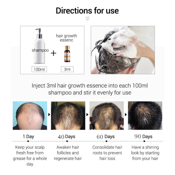 Hair Care Hair Growth Essential Oils Essence Original Authentic 100 Hair Loss Liquid Health Care Beauty 9 Beauty-Health Hair Care Hair Growth Essential Oils