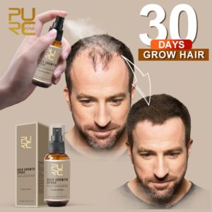 PURC New Hair Growth Spray Fast Grow Hair hair loss Treatment For Thinning Hair Hair Care Beauty-Health Mega Shop