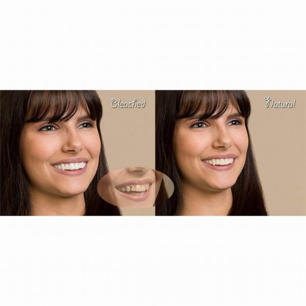 Silicone Upper Lower False Teeth Perfect Instant Smile Veneers Cosmetic Teeth Veneer Dentures for Woman and 4 Beauty-Health Cosmetic Teeth Veneer Dentures