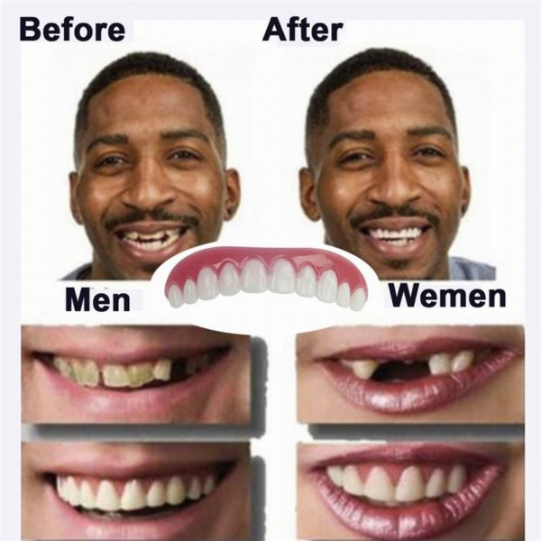 Silicone Upper Lower False Teeth Perfect Instant Smile Veneers Cosmetic Teeth Veneer Dentures for Woman and 5 Beauty-Health Cosmetic Teeth Veneer Dentures
