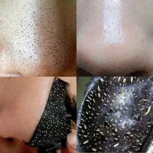 10 PCS Nose Blackhead Remover Mask Deep Cleansing Skin Care Shrink Pore Acne Treatment Mask Nose 3 Beauty-Health 10 PCS Nose Blackhead Remover Mask