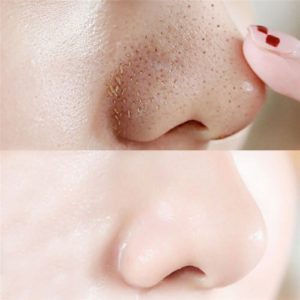 10 PCS Nose Blackhead Remover Mask Deep Cleansing Skin Care Shrink Pore Acne Treatment Mask Nose 4 Beauty-Health 10 PCS Nose Blackhead Remover Mask