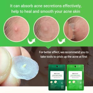 BREYLEE Acne Pimple Patch Stickers Acne Treatment Pimple Remover Tool Blemish Spot Facial Mask Skin Care 1 Beauty-Health Acne Pimple Patch Stickers