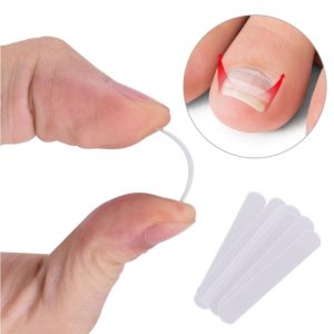 10pcs Ingrown Toenail Correction Tool Ingrown Toe Nail Treatment Elastic Patch Sticker Straightening Clip Brace Pedicure Beauty-Health Vendor Shop