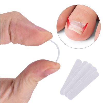 10pcs Ingrown Toenail Correction Tool Ingrown Toe Nail Treatment Elastic Patch Sticker Straightening Clip Brace Pedicure Beauty-Health Products
